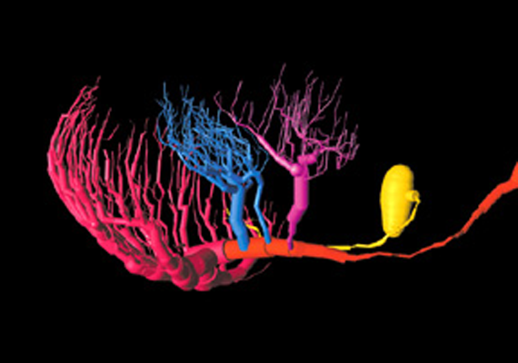 reconstruction of LGMD neuron